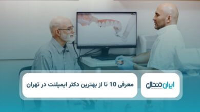 بهترین دکتر ایمپلنت در تهران