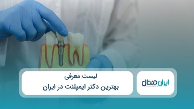 بهترین دکتر ایمپلنت در ایران