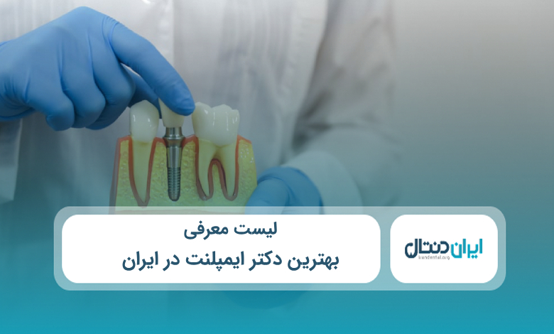 بهترین دکتر ایمپلنت در ایران