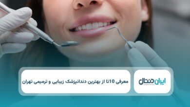 بهترین دندانپزشک زیبایی و ترمیمی در تهران