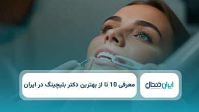 بهترین دکتر بلیچینگ در ایران