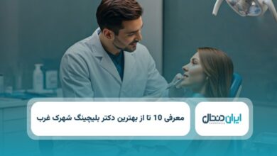 بهترین دکتر بلچینگ در شهرک غرب