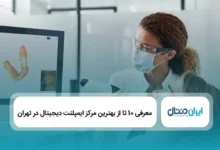 بهترین مرکز ایمپلنت دیجیتال در تهران