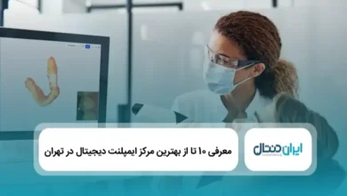 بهترین مرکز ایمپلنت دیجیتال در تهران