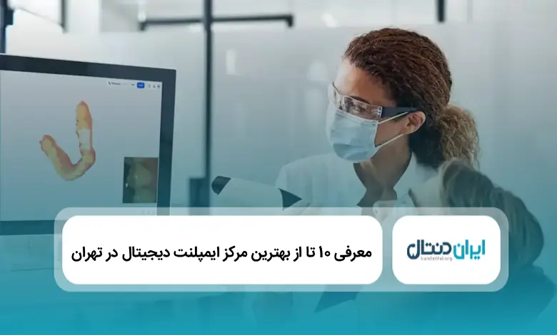 بهترین مرکز ایمپلنت دیجیتال در تهران
