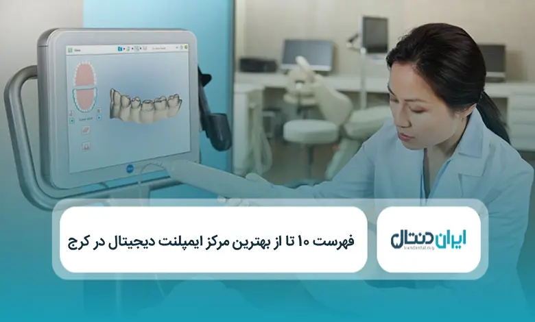 بهترین مرکز ایمپلنت دیجیتال در کرج