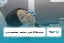 بهترین متخصص ایمپلنت در جردن