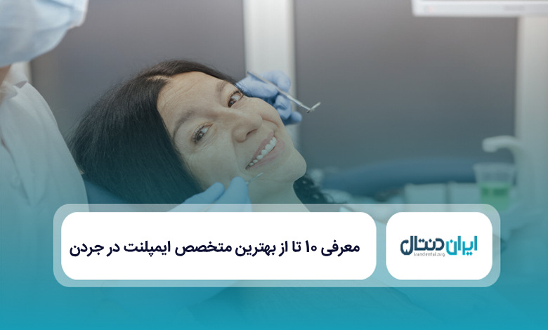بهترین متخصص ایمپلنت در جردن