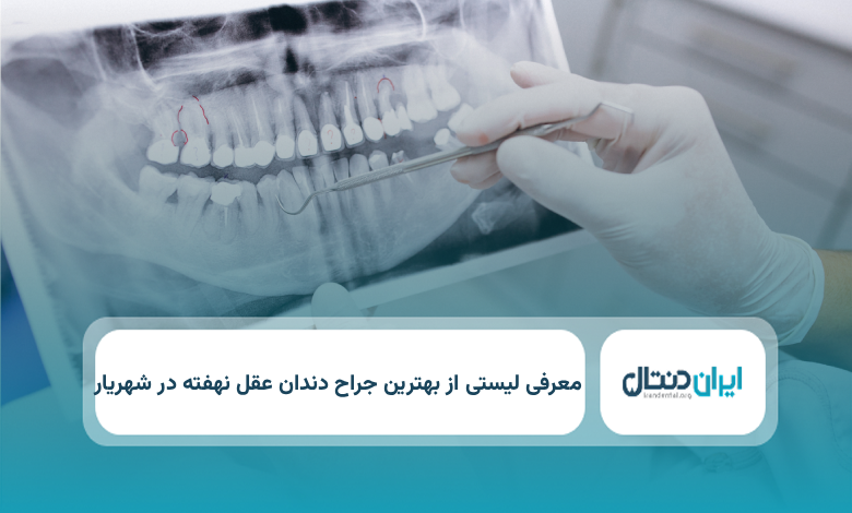 بهترین جراح دندان عقل نهفته در شهریار