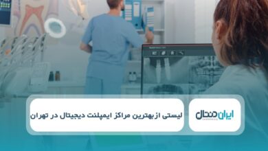 بهترین مرکز ایمپلنت دیجیتال در تهران