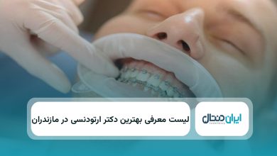 بهترین دکتر ارتودنسی در مازندران