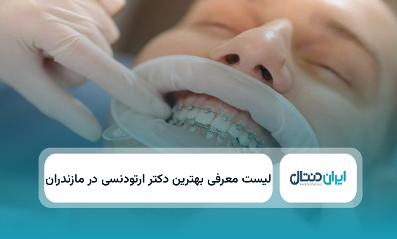 بهترین دکتر ارتودنسی در مازندران
