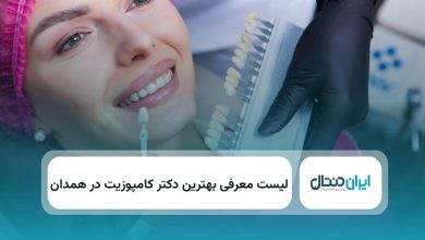 بهترین دکتر کامپوزیت در همدان