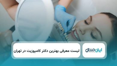 بهترین دکتر کامپوزیت در تهران
