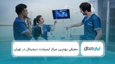 بهترین مرکز ایمپلنت دیجیتال در تهران