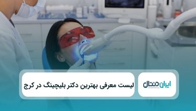 بهترین دکتر بلیچینگ دندان در کرج