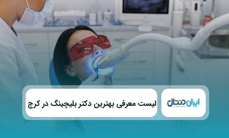 بهترین دکتر بلیچینگ دندان در کرج