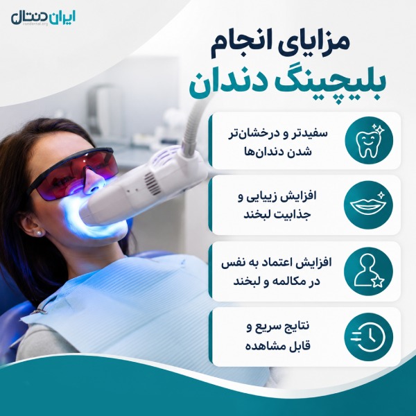 مزایای انجام بلیچینگ دندان در کرج