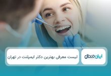 بهترین دکتر ایمپلنت در تهران
