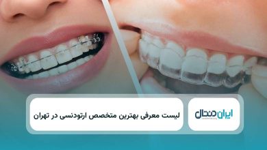 بهترین دکتر ارتودنسی در تهران