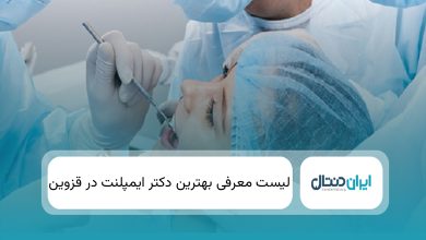 بهترین دکتر ایمپلنت در قزوین