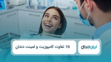 10 تفاوت کامپوزیت و لمینت دندان