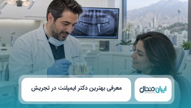 بهترین دکتر ایمپلنت در تجریش