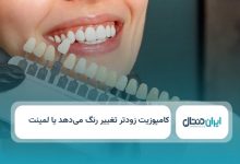 کامپوزیت زودتر تغییر رنگ می دهد یا لمینت؟