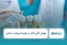عوامل تاثیر گذار در هزینه ایمپلنت دندان