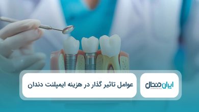 عوامل تاثیر گذار در هزینه ایمپلنت دندان