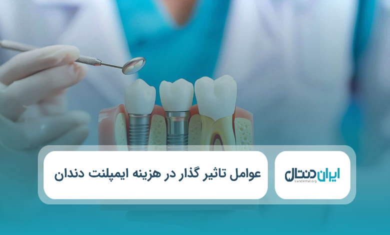 عوامل تاثیر گذار در هزینه ایمپلنت دندان