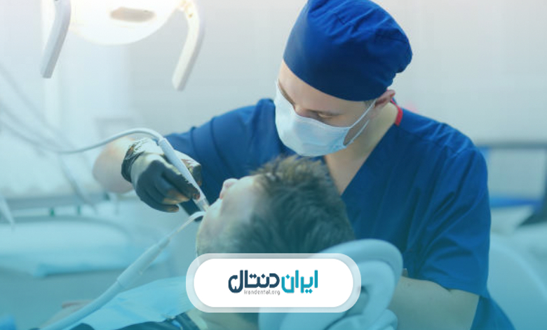 هزینه انواع روشهای ایمپلنت دندان چقدر است؟