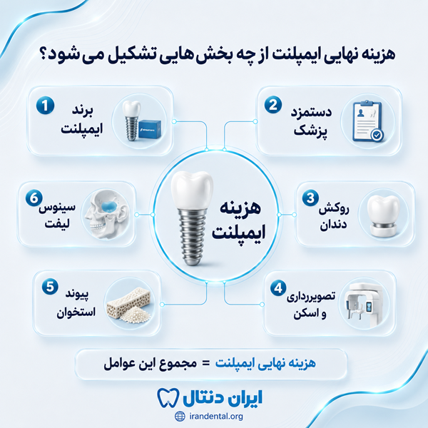 هزینه ایمپلنت دندان چگونه محاسبه میشود؟