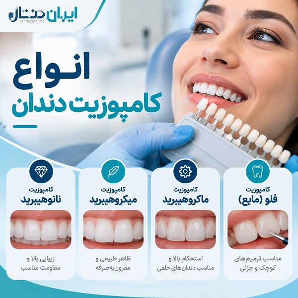 انواع کامپوزیت دندان
