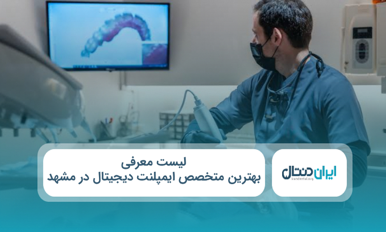 بهترین متخصص ایمپلنت دیجیتال در مشهد