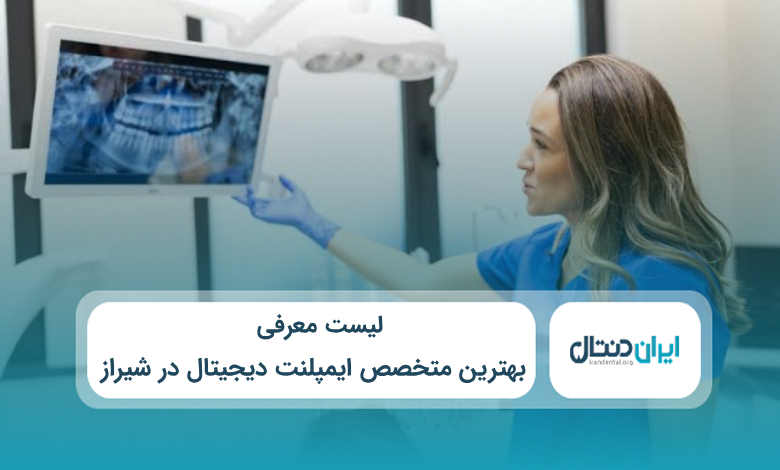 بهترین متخصص ایمپلنت دیجیتال در شیراز