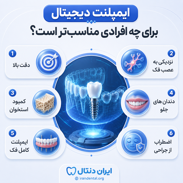 برای پیدا کردن دکتر ایمپلنت در شیراز به چه نکاتی توجه کنیم؟