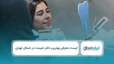 بهترین متخصص لمینت در شمال تهران