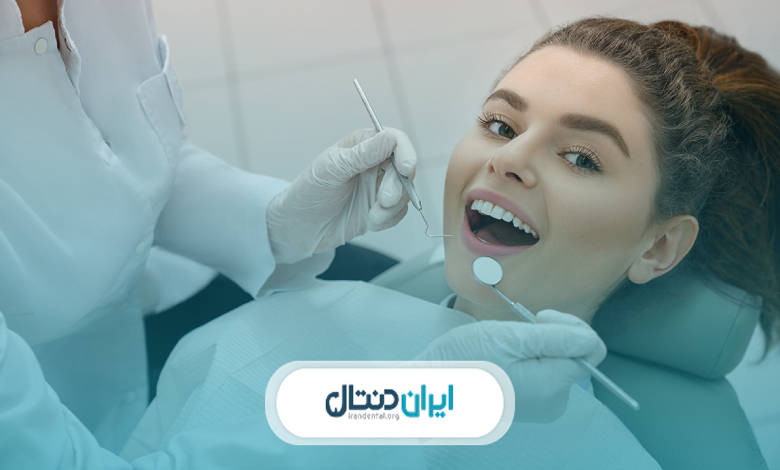 لمینت دندان برای چه افرادی مناسب است؟