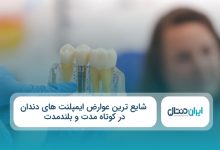 شایع‌ ترین عوارض ایمپلنت های دندان در کوتاه‌ مدت و بلندمدت