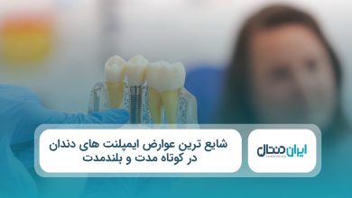 شایع‌ ترین عوارض ایمپلنت های دندان در کوتاه‌ مدت و بلندمدت