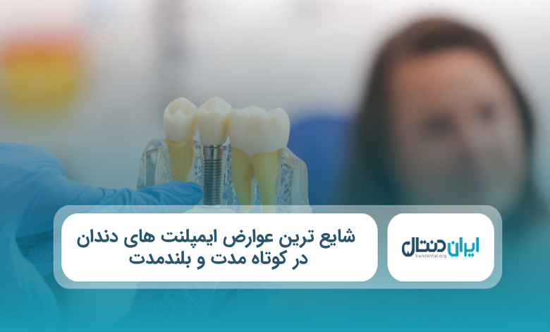 شایع‌ ترین عوارض ایمپلنت های دندان در کوتاه‌ مدت و بلندمدت