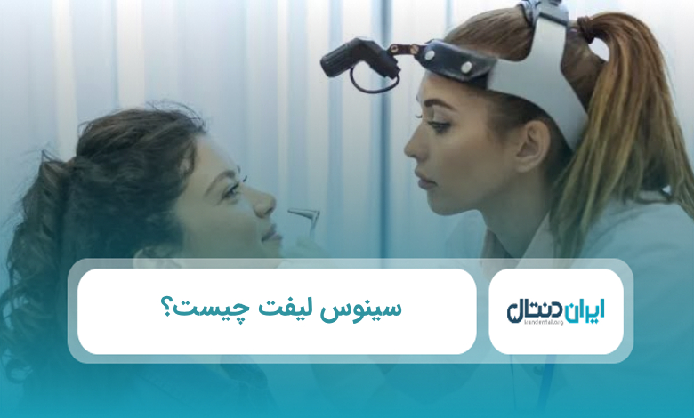 سینوس لیفت چیست؟