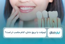 ایمپلنت یا بریج دندان کدام مناسب تر است؟
