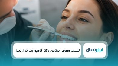بهترین دکتر کامپوزیت در اردبیل