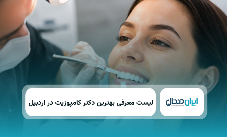 بهترین دکتر کامپوزیت در اردبیل