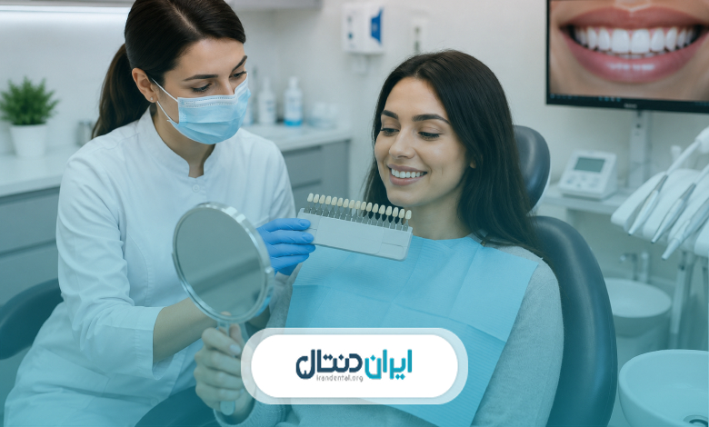 بلیچینگ دندان چیست و برای چه کسانی مناسب است؟
