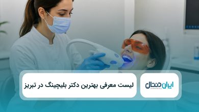 بهترین دکتر بلیچینگ در تبریز
