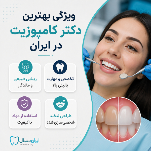 معیار های انتخاب بهترین دکتر کامپوزیت در ایران