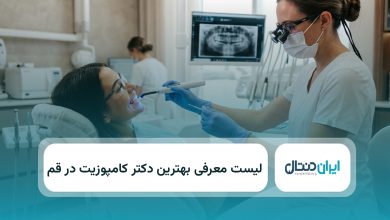بهترین دکتر کامپوزیت در قم